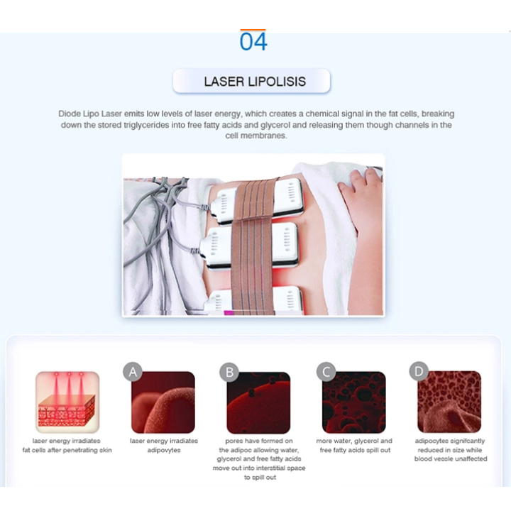 Kavitacijos RF BIO Lazerio aparatas | Medisa.lt