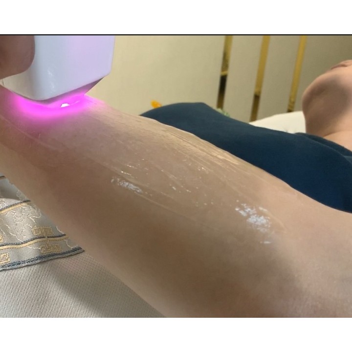 Epiliacijos diodo lazeris 808 nm | Medisa.lt