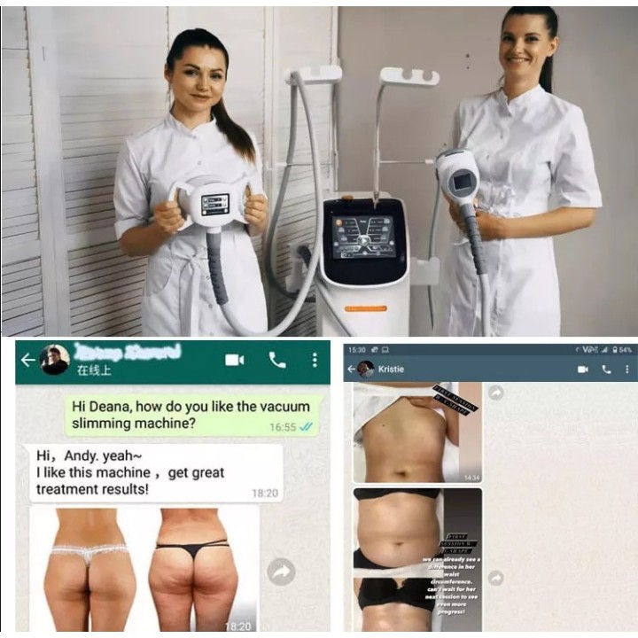 Velashape 3 vakuumo lazerio aparatas 6-1 | Medisa.lt