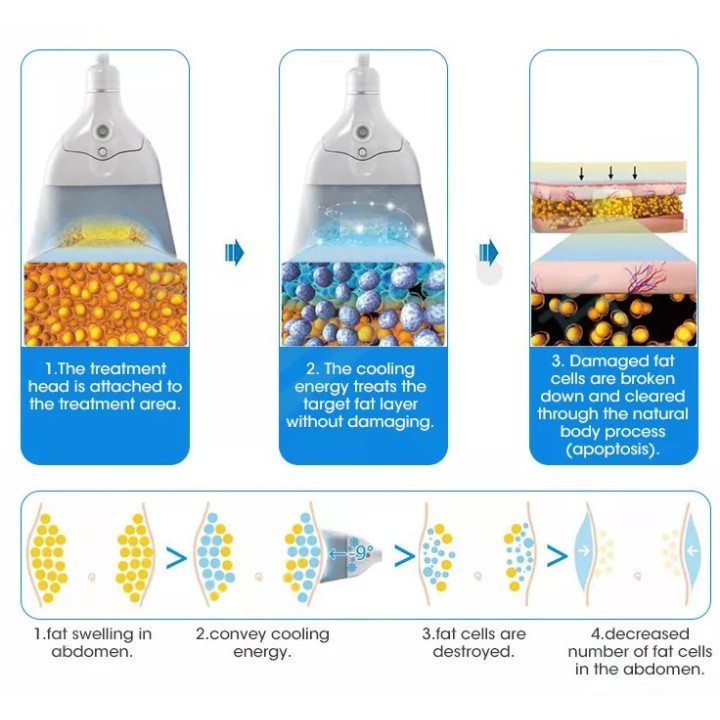 Cryo Freezing + HI-EMT lieknėjimo aparatas 2–1 | Medisa.lt