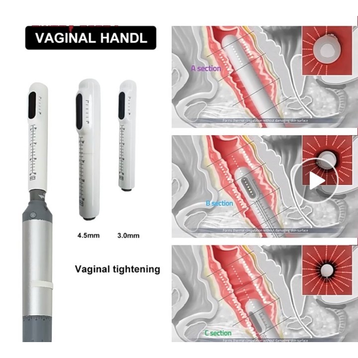 HIFU Veido Kūno ultragarsinis liposakcinis aparatas | Medisa.lt