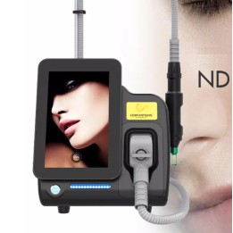 Yag Laser lazeris | Medisa.lt
