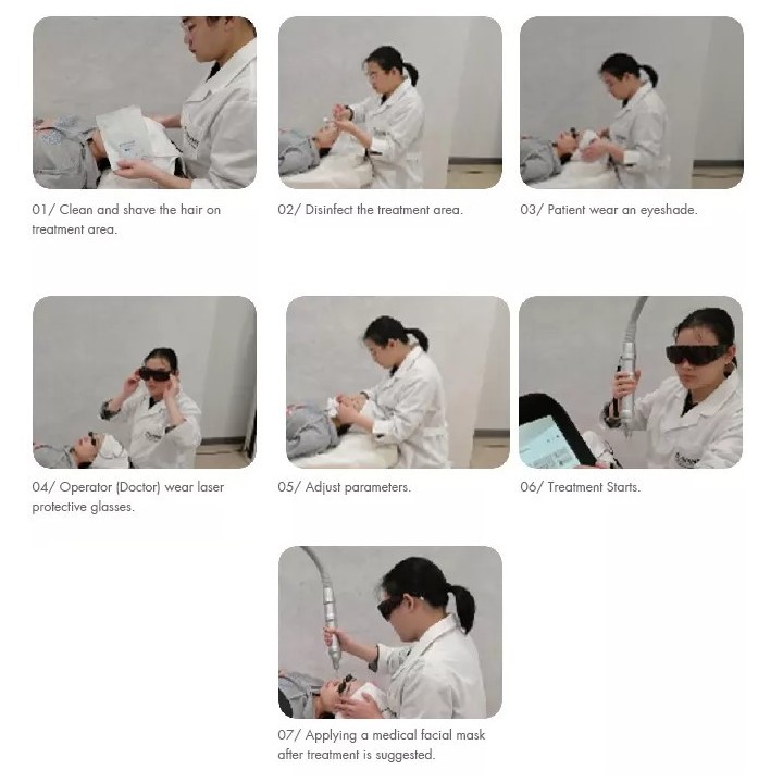 Yag Laser lazeris | Medisa.lt