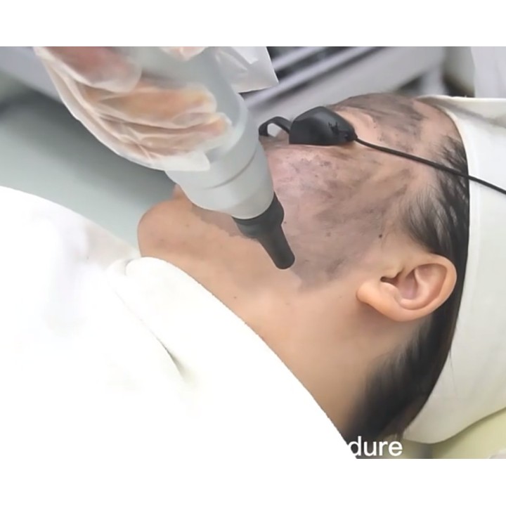 Yag Laser lazeris | Medisa.lt