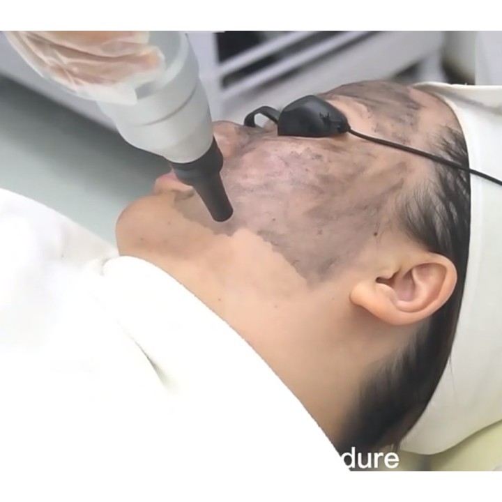 Yag Laser lazeris | Medisa.lt