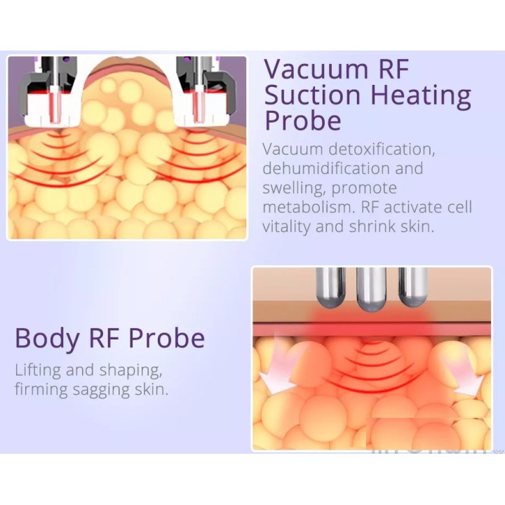 Ultragarso kavitacijos vakuuminis RF Bio lipo lazerinis | Medisa.lt