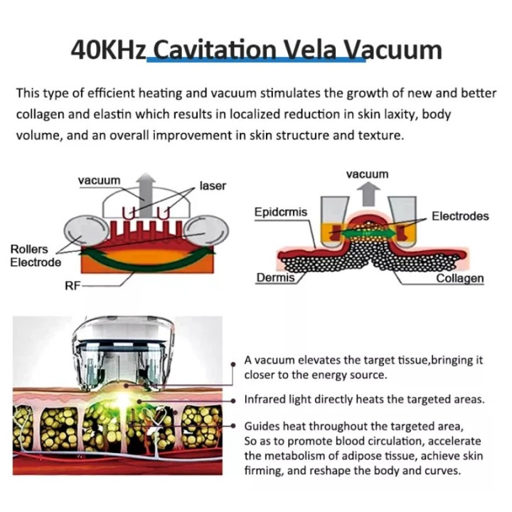 Velashape Cryo kavitacijos vakuumo mašina 2 in 1 | Medisa.lt