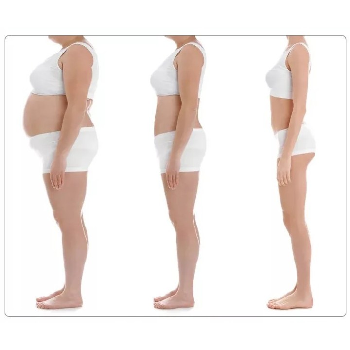 Velashape Cryo kavitacijos vakuumo mašina 2 in 1 | Medisa.lt