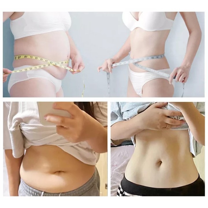 Velashape Cryo kavitacijos vakuumo mašina 2 in 1 | Medisa.lt
