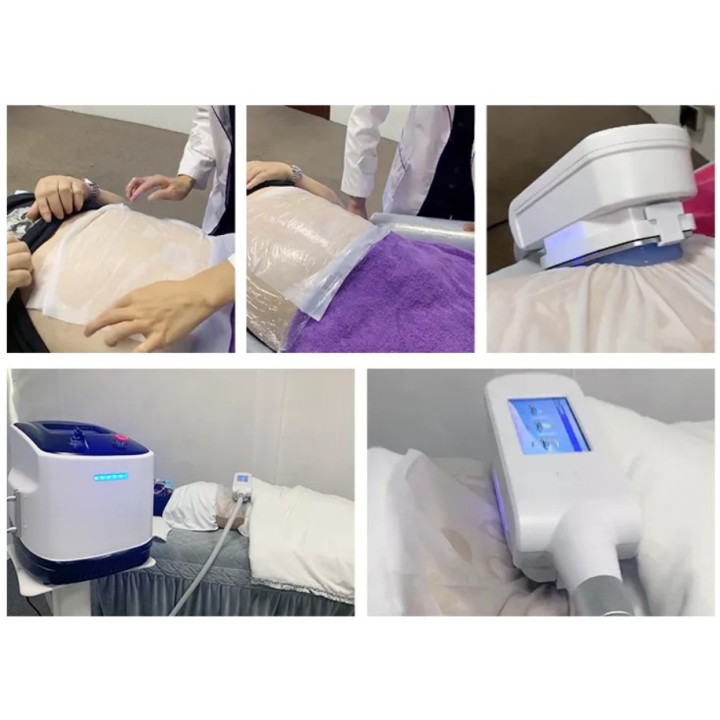 Velashape Cryo kavitacijos vakuumo mašina 2 in 1 | Medisa.lt