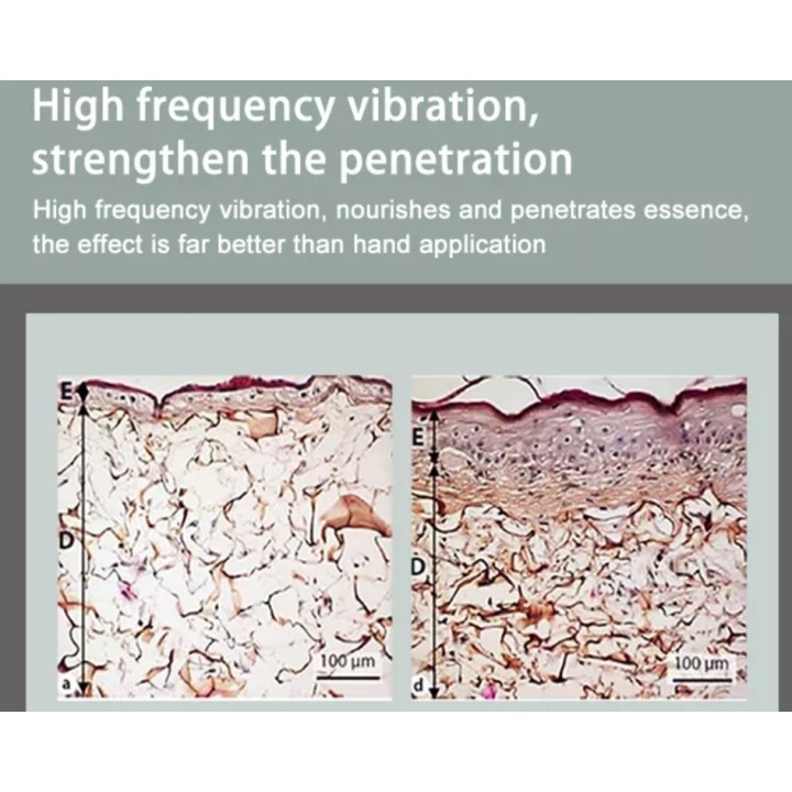 Veido terapijos aparatas Hydra Oxy M6 odai atjauninti | Medisa.lt