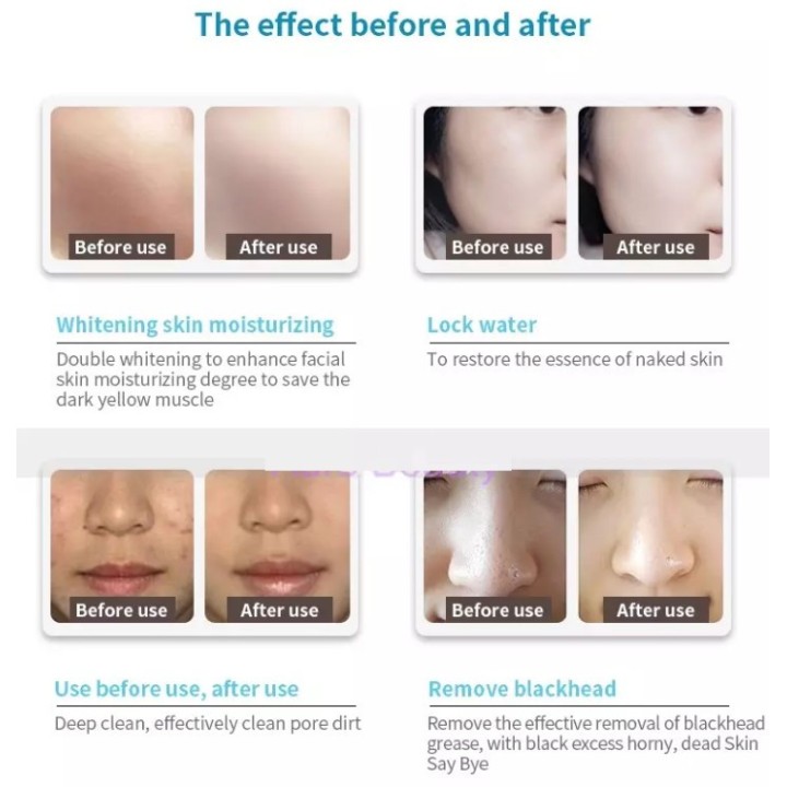 Hydrafacial veido priežiūros aparatas 8-1 | Medisa.lt