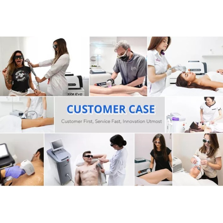 Psoriazės vitiligo eksimerinis 308nm lazeris | Medisa.lt