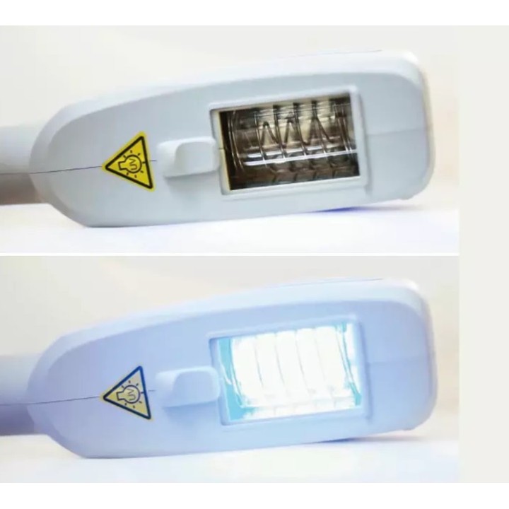 Psoriazės vitiligo eksimerinis 308nm lazeris | Medisa.lt