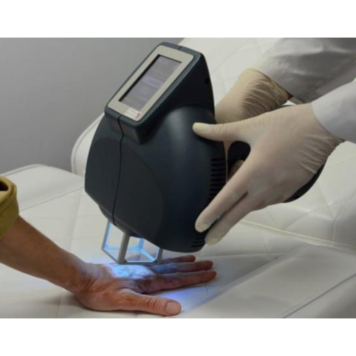 Excimer 308 nm lazeris | Medisa.lt